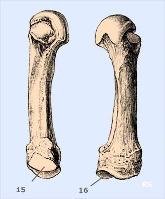 MHK V Mittelhandknochen