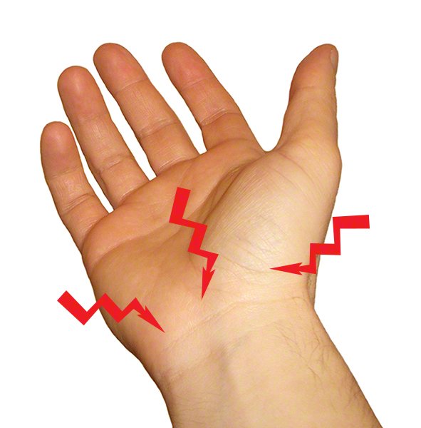 handgelenk-schmerzen-hand