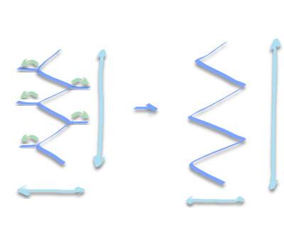 Darstellung der V-Y-Plastik