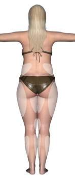 Bereiche der Liposuktion hinten